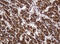 B- and T-lymphocyte attenuator antibody, M03149, Boster Biological Technology, Immunohistochemistry paraffin image 