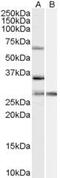 Pre-MRNA Processing Factor 31 antibody, PA5-18611, Invitrogen Antibodies, Western Blot image 