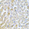 Eukaryotic translation initiation factor 3 subunit M antibody, LS-C333313, Lifespan Biosciences, Immunohistochemistry paraffin image 