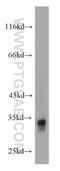 Four And A Half LIM Domains 2 antibody, 21619-1-AP, Proteintech Group, Western Blot image 