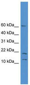 Small Nuclear RNA Activating Complex Polypeptide 5 antibody, TA344536, Origene, Western Blot image 
