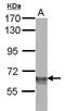 SWI/SNF Related, Matrix Associated, Actin Dependent Regulator Of Chromatin, Subfamily D, Member 3 antibody, PA5-29436, Invitrogen Antibodies, Western Blot image 