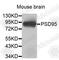 Discs Large MAGUK Scaffold Protein 4 antibody, A6194, ABclonal Technology, Western Blot image 