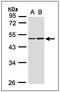Isocitrate Dehydrogenase (NADP(+)) 1, Cytosolic antibody, AP23607PU-N, Origene, Western Blot image 