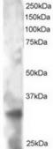 Tetraspanin 32 antibody, TA302792, Origene, Western Blot image 