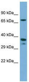 Nuclear Receptor Subfamily 2 Group E Member 1 antibody, TA338239, Origene, Western Blot image 