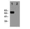 Perforin 1 antibody, ALX-804-057-C100, Enzo Life Sciences, Western Blot image 