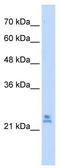 Mitochondrial Ribosomal Protein S15 antibody, TA345422, Origene, Western Blot image 