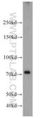 Regulatory Factor X3 antibody, 14784-1-AP, Proteintech Group, Western Blot image 