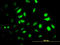 Proteasome 26S Subunit, ATPase 2 antibody, LS-C198018, Lifespan Biosciences, Immunofluorescence image 