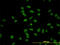 Cytidine Monophosphate N-Acetylneuraminic Acid Synthetase antibody, LS-C105158, Lifespan Biosciences, Immunofluorescence image 