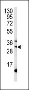 3-mercaptopyruvate sulfurtransferase antibody, 63-103, ProSci, Western Blot image 