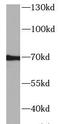 AHSG antibody, FNab09916, FineTest, Western Blot image 