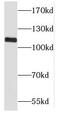 Protein CASC3 antibody, FNab05220, FineTest, Western Blot image 