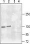 Trk antibody, TA328905, Origene, Western Blot image 
