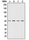 Akt antibody, LS-C351807, Lifespan Biosciences, Western Blot image 