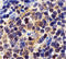 Survivin antibody, 2237, ProSci, Immunohistochemistry paraffin image 