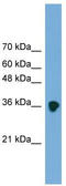 Secreted frizzled-related protein 3 antibody, TA335007, Origene, Western Blot image 