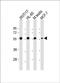 DIP antibody, PA5-49505, Invitrogen Antibodies, Western Blot image 