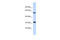 Polycomb group RING finger protein 3 antibody, 28-084, ProSci, Enzyme Linked Immunosorbent Assay image 