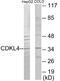 Cyclin Dependent Kinase Like 4 antibody, EKC1850, Boster Biological Technology, Western Blot image 