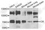 Intestinal Cell Kinase antibody, A7783, ABclonal Technology, Western Blot image 