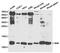 B2M antibody, TA327075, Origene, Western Blot image 