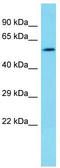 UDP-Glucose 6-Dehydrogenase antibody, TA343136, Origene, Western Blot image 