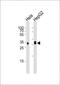 Palmitoyl-Protein Thioesterase 1 antibody, MA5-24731, Invitrogen Antibodies, Western Blot image 