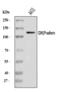 Cadherin 3 antibody, A03353-2, Boster Biological Technology, Western Blot image 