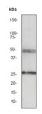 Sonic hedgehog protein antibody, ab53281, Abcam, Western Blot image 