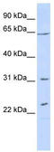 Crossover junction endonuclease EME1 antibody, TA338858, Origene, Western Blot image 