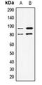 Signal Transducer And Activator Of Transcription 1 antibody, orb214618, Biorbyt, Western Blot image 