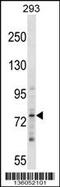 Zinc Finger Protein 81 antibody, 58-553, ProSci, Western Blot image 