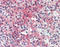 C-C Motif Chemokine Ligand 5 antibody, TA318049, Origene, Immunohistochemistry frozen image 