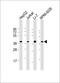 Rho Guanine Nucleotide Exchange Factor 39 antibody, 61-164, ProSci, Western Blot image 