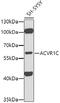 Activin A Receptor Type 1C antibody, 13-243, ProSci, Western Blot image 