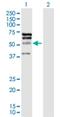ETS Transcription Factor ELK4 antibody, H00002005-D01P, Novus Biologicals, Western Blot image 