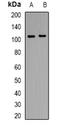 CD13 antibody, LS-C413346, Lifespan Biosciences, Western Blot image 