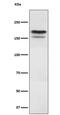 Histone-lysine N-methyltransferase EHMT2 antibody, M01055-1, Boster Biological Technology, Western Blot image 