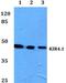 Potassium Voltage-Gated Channel Subfamily J Member 10 antibody, PA5-37137, Invitrogen Antibodies, Western Blot image 