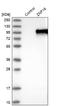 Zinc Finger Protein 16 antibody, NBP1-81343, Novus Biologicals, Western Blot image 