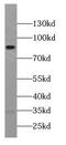 Acc1 antibody, FNab02089, FineTest, Western Blot image 