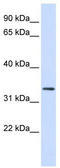 F-box only protein 25 antibody, TA329821, Origene, Western Blot image 