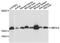 Ubiquitin/ISG15-conjugating enzyme E2 L6 antibody, A13670, ABclonal Technology, Western Blot image 
