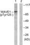 WASP Family Member 1 antibody, GTX55451, GeneTex, Western Blot image 