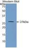 Monoamine Oxidase A antibody, LS-C301323, Lifespan Biosciences, Western Blot image 