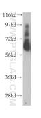 MYOC antibody, 14238-1-AP, Proteintech Group, Western Blot image 