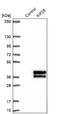 Kinesin Family Member 25 antibody, NBP1-92055, Novus Biologicals, Western Blot image 