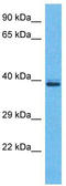Olfactory Receptor Family 5 Subfamily H Member 2 antibody, TA337526, Origene, Western Blot image 